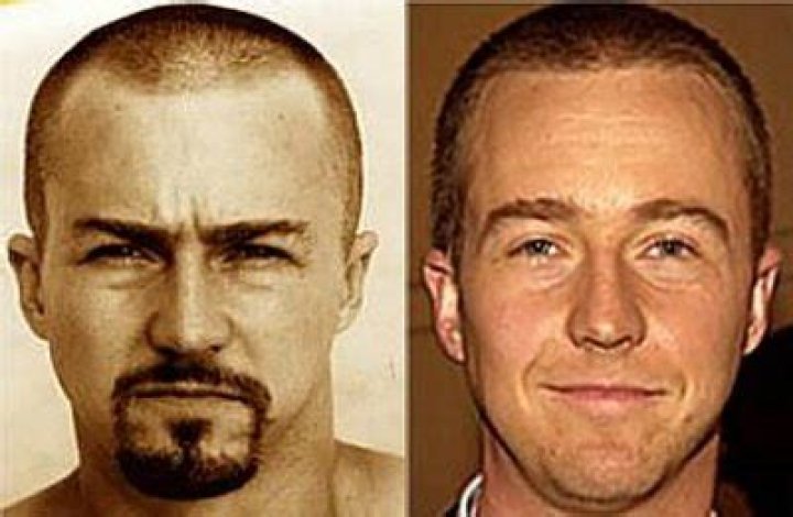 Edward Norton Plastic Surgery Before and After