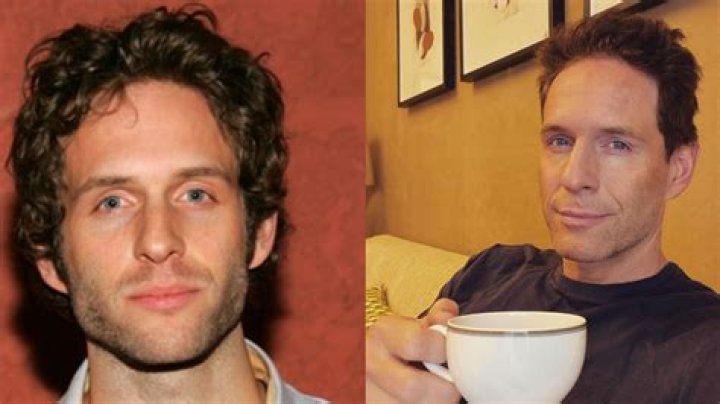 Glenn Howerton Plastic Surgery: Journey Through Changes and Controversies