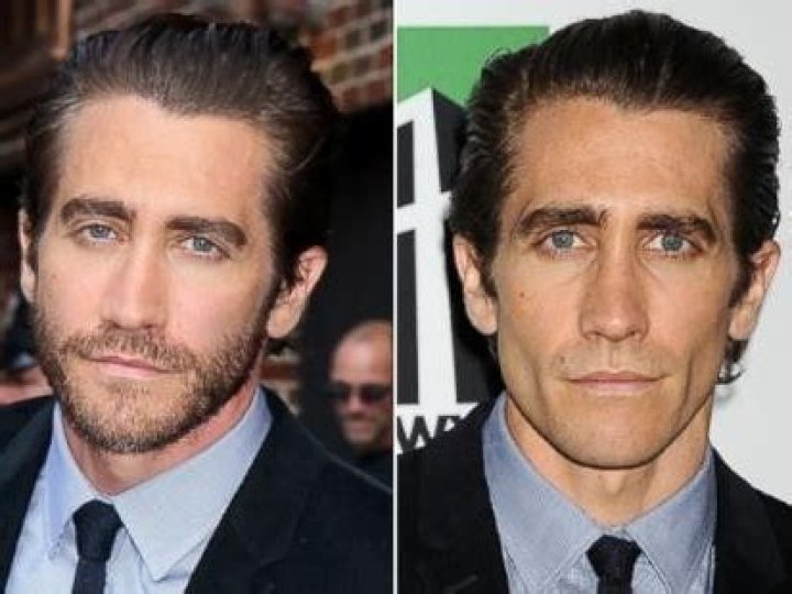 Jake Gyllenhaal Plastic Surgery Before and After