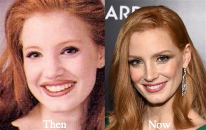 Jessica Chastain Plastic Surgery: The Noticeably Different Facial Features of The Actress!