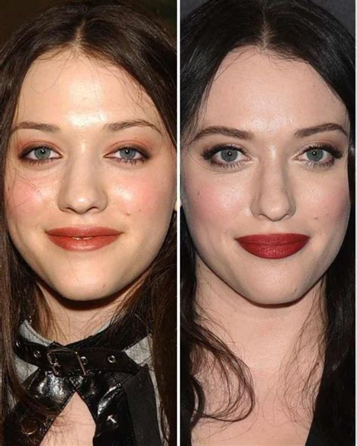 Kat Dennings Plastic Surgery Before and After