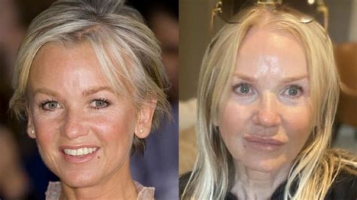 Lisa Maxwell Plastic Surgery: Maxewell's journey of learning to embrace naturally!