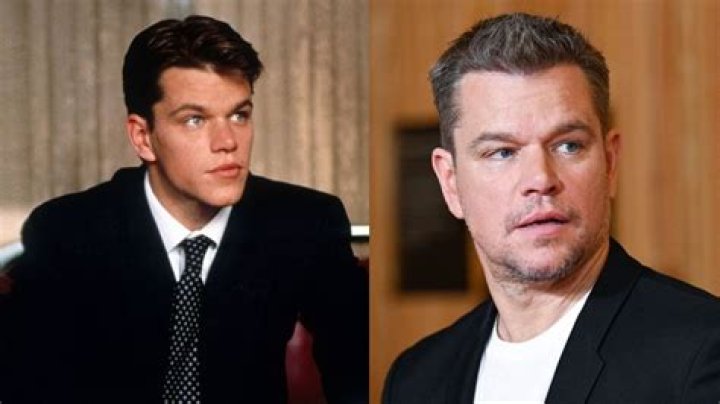 Matt Damon Plastic Surgery Before and After