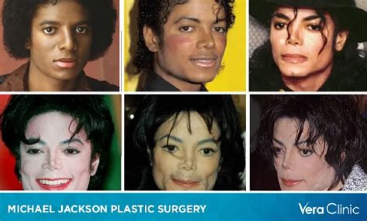Michael Jackson Plastic Surgery: A Journey Through Transformation and Controversy